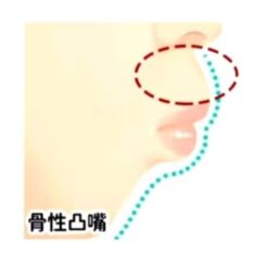海狸家口腔：科学矫正可减少拔牙概率给牙齿一次不搬家机会(图1)